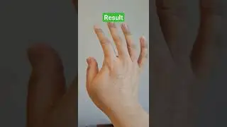 Keep your hands safe