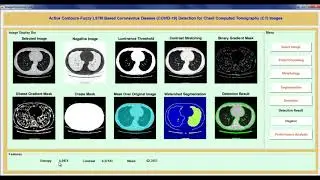 Covid 19 Detection using Image Processing | Image Processing Matlab Code Projects
