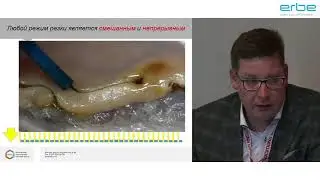 Режимы работы электрохирургического оборудования Erbe VIO. Какой, когда и почему я предпочитаю.