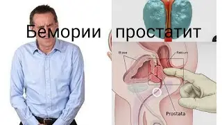 Бемории простатит шадид ва музмин.