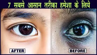 हमेशा के लिए कहे बाये- बाये !! आँखों के काले घेरे से छुटकारा पाने के आसान तरीके !!