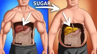 What Sugar Does To Your Body (Science-Based)