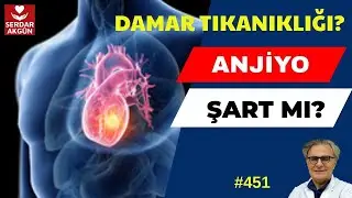 451. Damar tıkanıklığı nasıl anlaşılır? Riski nedir?Anjiyo şart mı? Serdar Akgün, Sağlık Videoları..