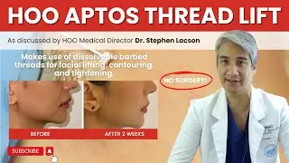 APTOS THREAD LIFTING