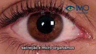 IMO - Conjuntivite - Medidas de prevenção