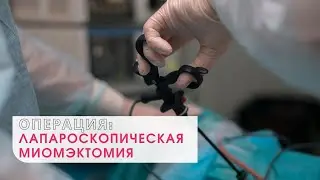 UTERINE FIBROID REMOVAL: A DOCTOR'S OPINION ON THE SURGERY AND REHABILITATION