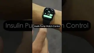 Do you want smartwatch control for your insulin pump? Watch full future pumps convo on the podcast!
