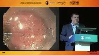 «Никогда не говори никогда» - удаление подслизистого новообразования пищевода