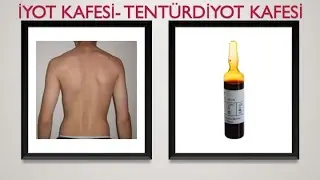 TENTÜRDİYOT KAFESİ, İYOT KAFESİ: GEÇMEYEN ÖKSÜRÜĞÜ OLANLAR BU VİDEOYU MUTLAKA İZLEMELİ