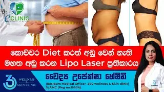 කොච්චර diet කරත් අඩු වෙන් නැති මහත අඩු කරන lipo laser ප්‍රතිකාරය