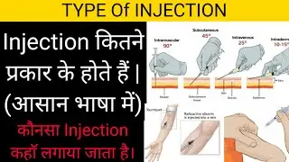TYPE Of INJECTION (injection कितने प्रकार के होते हैं।) कौनसा Injection कहॉ लगाया जाता है||