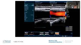 How to use dual screen on the Mindray Z60