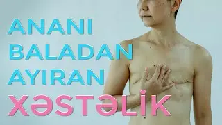 Ananı baladan ayıran xəstəlik | Doktor men