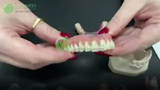 Prótese e Implante Dentário é na OdontoCompany Iguatemi