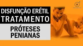 DISFUNÇÃO ERÉTIL - Tratamento para Disfunção Erétil através do uso de prótese peniana?