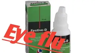 eye flu kiya hai / kaise failta hai / kaise pta lgae apko eye flu hai ya nhi #eyeflu