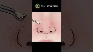 ASMR animation | Immersive nose blackhead removal animation