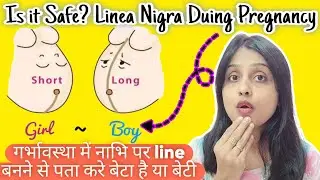 Is it Safe? Linea Nigra Duing Pregnancy ~गर्भावस्था में नाभि पर line बनने से पता करे बेटा है या बेटी