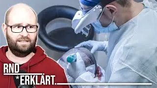 Warum so viele YouTuber Haartransplantationen machen lassen