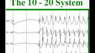 The International 10-20 system