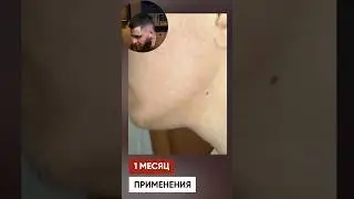 В 27 лет не росла борода. Но начал мазать ксиноксин