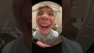 Fish eye clips