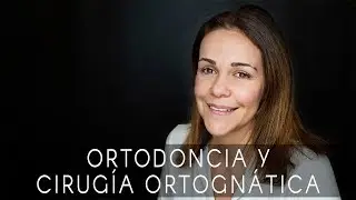 La sonrisa de Judith: tratamiento combinado de ortodoncia y cirugía ortognática