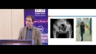 Функциональные результаты хирургического лечения пациентов с опухолевой патологией костей таза