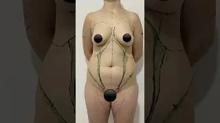 LipoHD de milhões! #lipo #lad você faria?