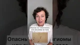 Опасны ли гемангиомы или ангиомы на теле