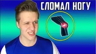 СЛОМАЛ НОГУ (ИСТОРИЯ ИЗ ЖИЗНИ)
