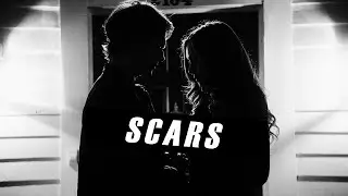 Scars || Damon/Elena [+7x04]