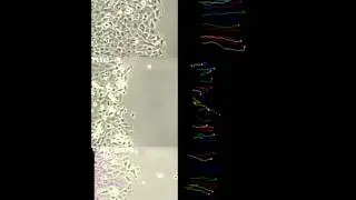 Time-lapse imaging of wound healing assay in TRIM15-depleted cells