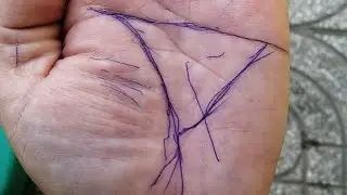 Bàn tay TAM GIÁC ĐỀU cực kỳ giàu
