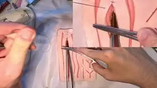 Fascial closure part 1
