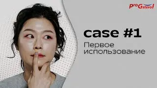 Кейс 1: Женщина, 34 года. Первое применение
