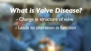 Dr. Marc Gerdisch discusses valve disease.