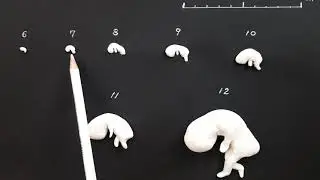 임신 초기 태아의 발달