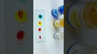 ABO blood group test 