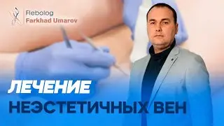 Лечение неэстетичных вен