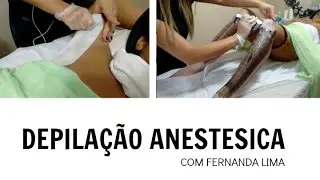 DEPILAÇÃO ANESTÉSICA / Depilação masculina