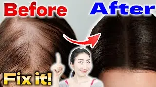 Boost Hair Growth in 45 days by Elevating Scalp Blood Flow with Easy Massage Techniques