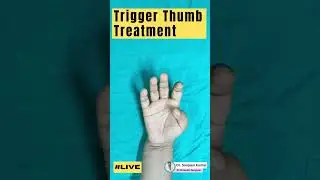 Trigger Thumb Treatment