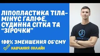 Антицелюлітний масаж, який гарантовано прибере галіфе, судинну сітку та 