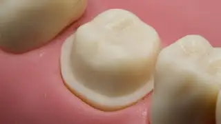 Lower Molar Crown Prep | ACC 30 | First Person Perspective
