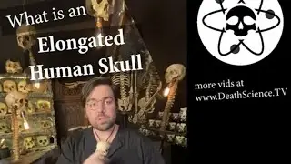 What is an Elongated Skull?