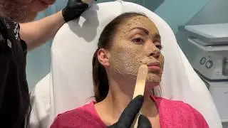 Cosmelan | Depigmentation Peel | Hyperpigmentation, Sun Damage | West Hollywood, CA | Dr. Jason Emer