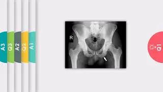 NAME THE STRUCTURE SERIES VIDEO NUMBER 3