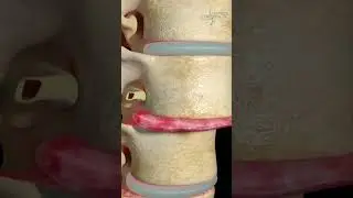 Gentle Chiropractic: Restoring Spinal Health #shorts #wellness