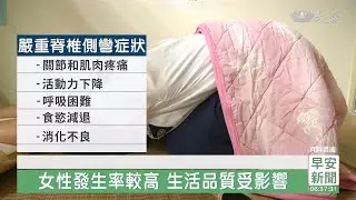 脊椎側彎女性發生率較高 生活品質受影響